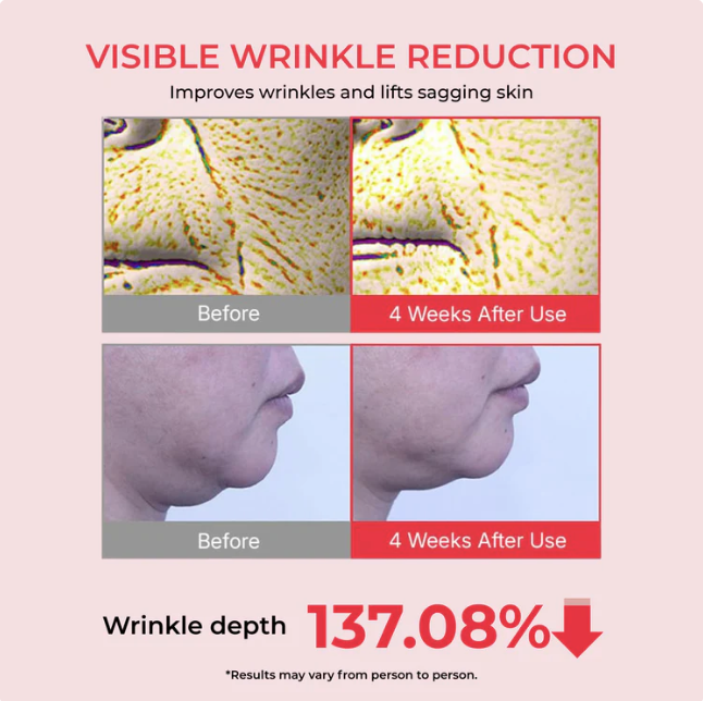 Highcote™ Time Reverse Cream (Korderm)