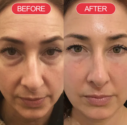 Highcote™ Time Reverse Cream (Korderm)