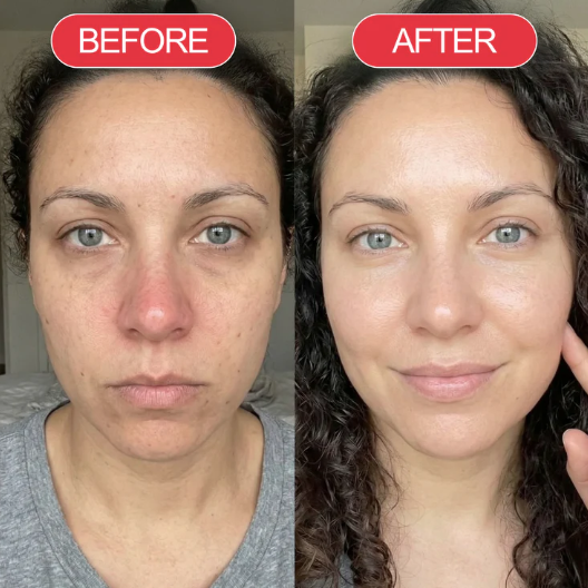 Highcote™ Time Reverse Cream (Korderm)