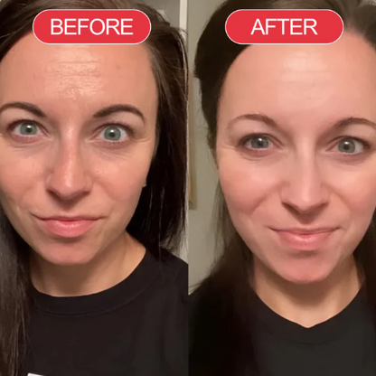 Highcote™ Time Reverse Cream (Korderm)
