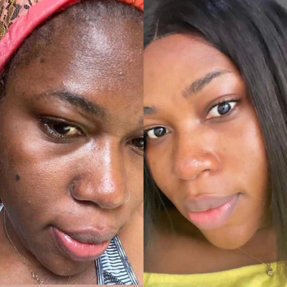 Arbutin + TXA Skincare Cream