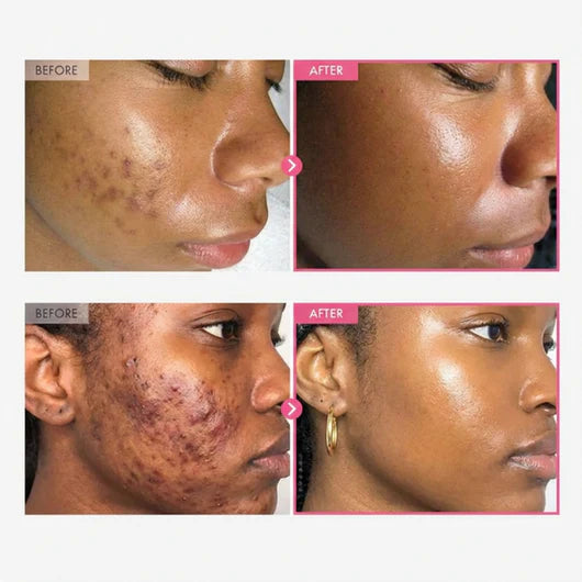Arbutin + TXA Skincare Cream
