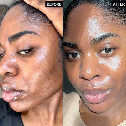 Arbutin + TXA Skincare Cream