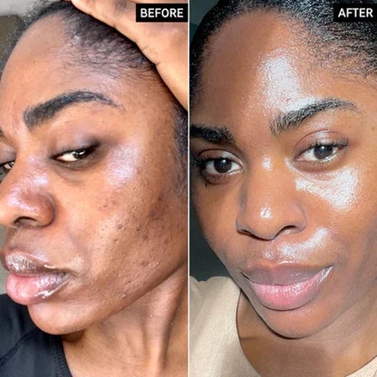 Arbutin + TXA Skincare Cream