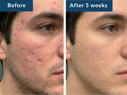 Copper Peptide Serum (GHK-Cu)