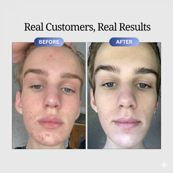 Copper Peptide Serum (GHK-Cu)