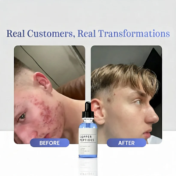 Copper Peptide Serum (GHK-Cu)