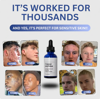Copper Peptide Serum (GHK-Cu)