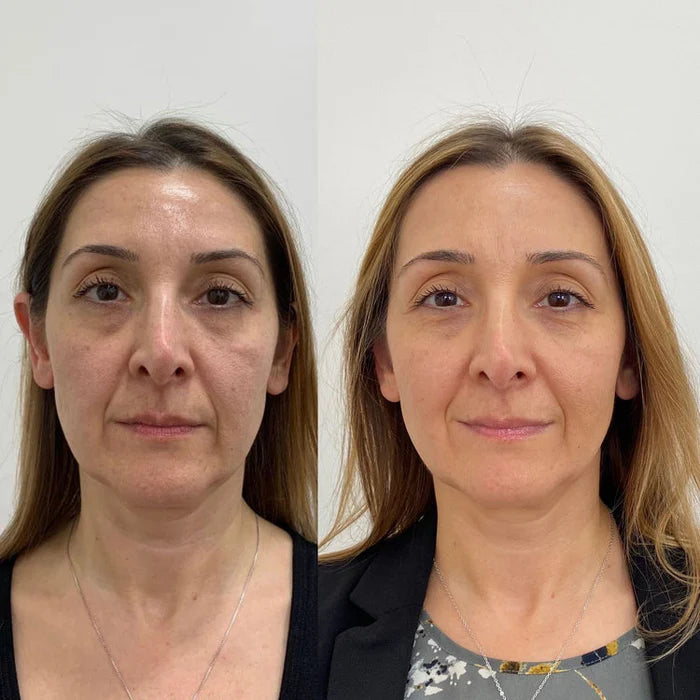 Highcote Calcium Balm